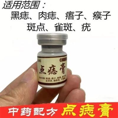 南京點痣多少錢?南京點痣的費用會受到多種因素影響，例如醫師的經驗、醫院的級別以及點痣的部位和範圍等。